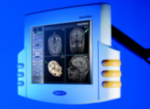 Neuronavigatie: scherm